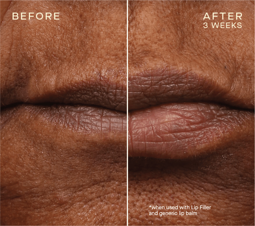 Lip Filler / Refill