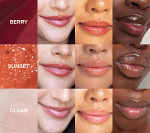 Cheek fillers
