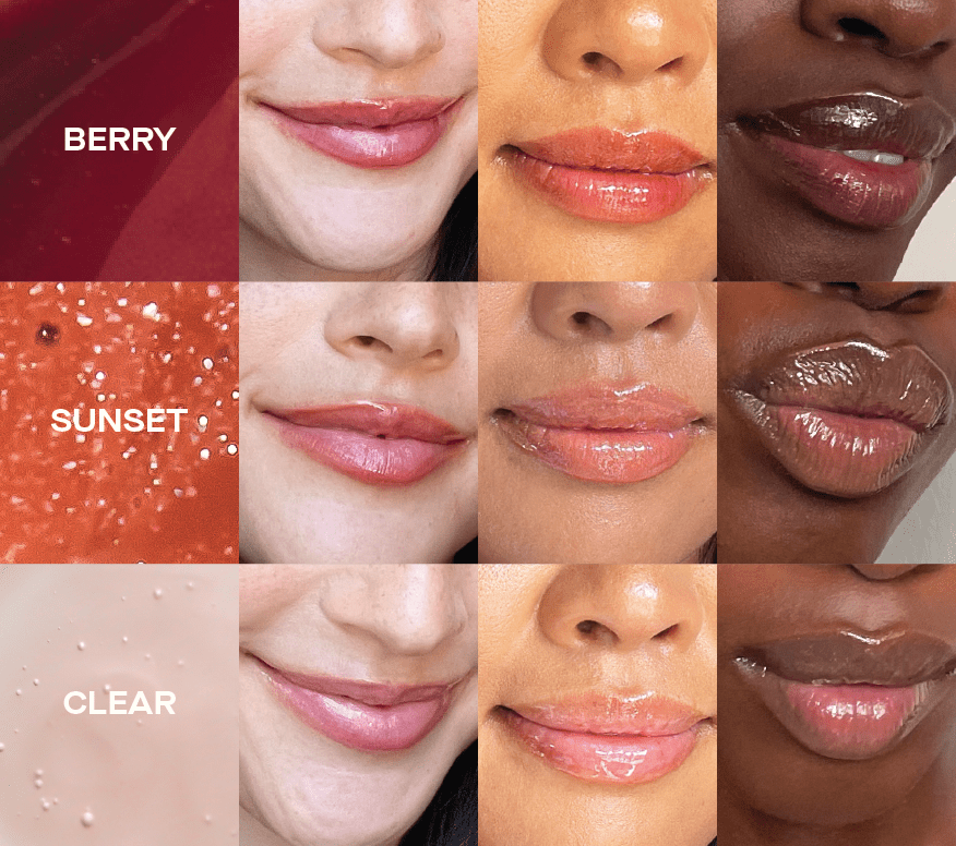 Cheek fillers