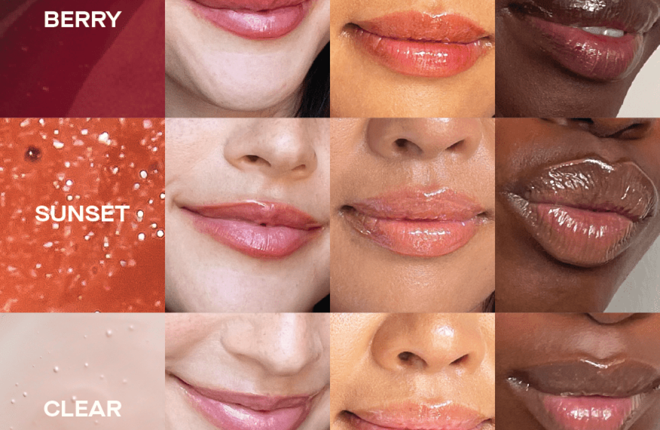 Cheek fillers